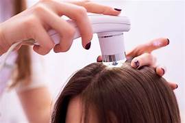 Scalp Analysis