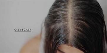 Oily Scalp Therapy